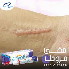 KASELO CREAM 50 GM